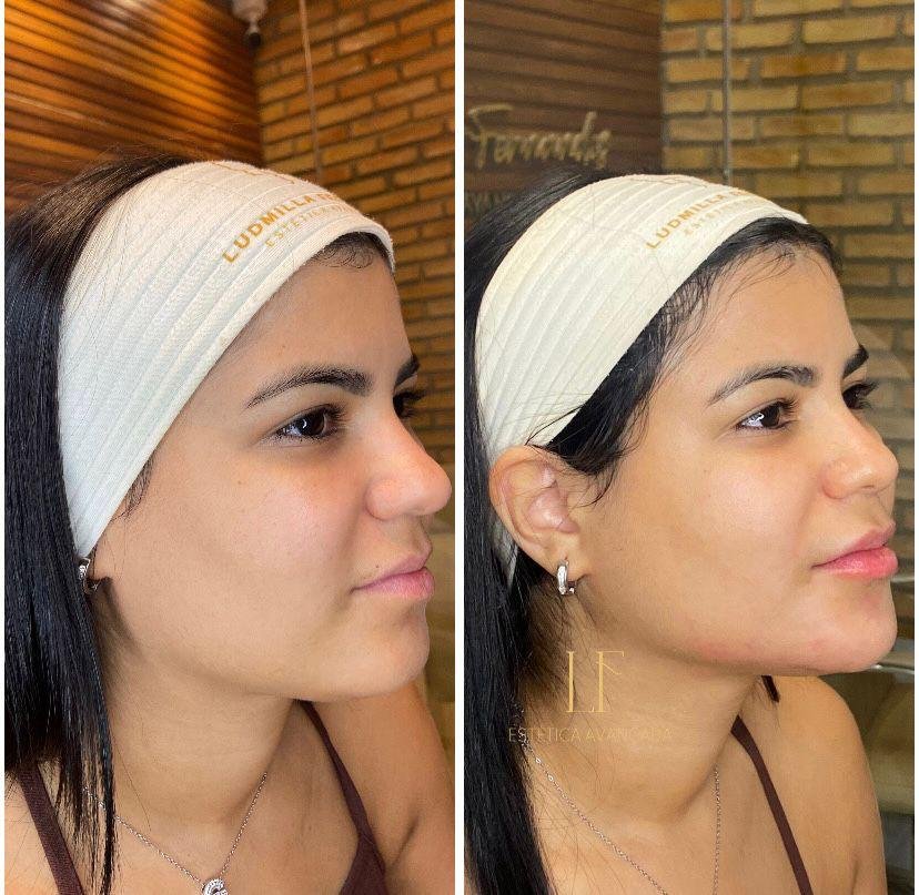 Antes e depois: acabamento e proporção